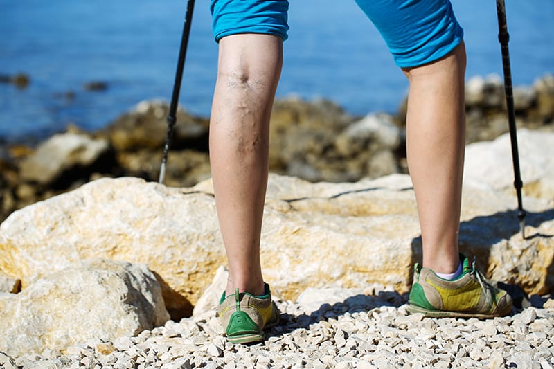 person hiking with visible veins on their calf